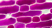 Onion epidermis plasmolysis, light micrograph