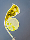 Stentor ciliate and Volvox algae colony, light micrograph