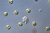 Volvox alga colony with amoeba parasite, light micrograph