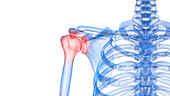 Painful shoulder, illustration