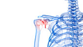 Painful shoulder, illustration