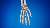 Arthritic hand, illustration