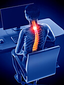Office worker's painful back, illustration