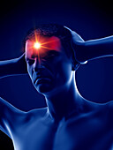 Man with a headache, illustration