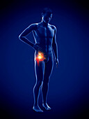 Man with a painful hip joint, illustration