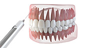 Dental anaesthesia, illustration