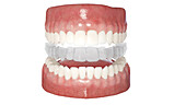 Clear dental aligner, illustration