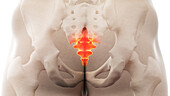 Painful coccyx, illustration