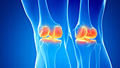 Painful knee joints, illustration