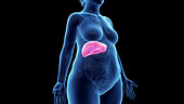 Obese woman's liver, illustration