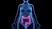 Obese woman's colon, illustration