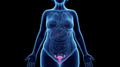 Obese woman's uterus, illustration