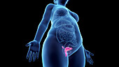 Obese woman's uterus, illustration