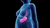 Obese woman's stomach, illustration