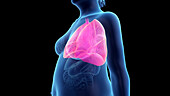 Obese woman's lung, illustration