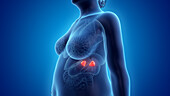 Obese woman's adrenal glands, illustration