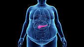 Obese man's pancreas, illustration