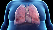 Obese man's heart and lungs, illustration