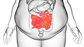 Obese man's small intestine, illustration