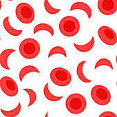 Normal blood and sickle cell blood, illustration