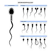 Sperm morphology, illustration