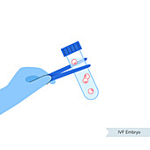 IVF embryos, illustration
