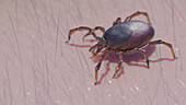 Tick on human skin, illustration