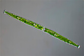 Gonatozygon brebissonii, algae, light micrograph