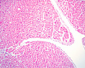 Human heart endocardium, light micrograph