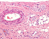 Muscular artery and nerves, light micrograph