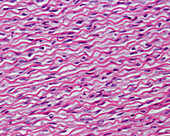 Elastic lamellae in human aorta, light micrograph