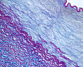 Muscular artery, light micrograph