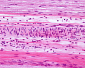 Arteriole, light micrograph