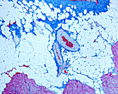 Heart pericardium, light micrograph