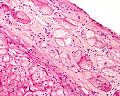 Purkinje fibres in the heart, light micrograph