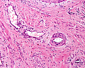 Blood vessels in connective tissue, light micrograph