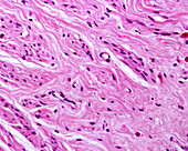 Blood vessels in connective tissue, light micrograph