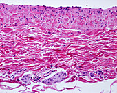 Large vein wall, light micrograph