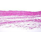 Large vein, light micrograph