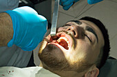 Doctor stitching up a wound after a tooth removal