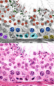 Spermatogenesis in human testicle, light micrographs