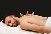 Cupping therapy