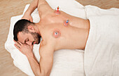 Cupping therapy