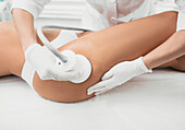 Anti-cellulite cavitation procedure