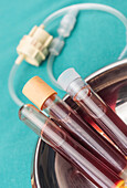 Blood samples in tubes, conceptual image