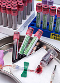Blood samples from patients with the ebola virus, conceptual image