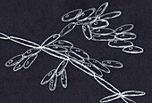 Candida kefyr yeasts, illustration