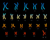 Normal male karyotype, illustration