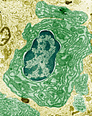 Intestinal cell, TEM
