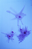 Amoeba sp., light micrograph